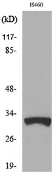 TFPI-2 Rabbit Polyclonal Antibody