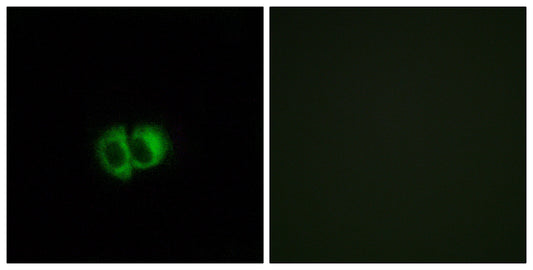 TG1019 Rabbit Polyclonal Antibody