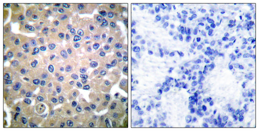 TGase2 Rabbit Polyclonal Antibody