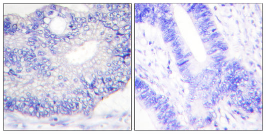TGFα Rabbit Polyclonal Antibody