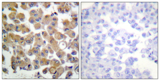 TGFβ1 Rabbit Polyclonal Antibody