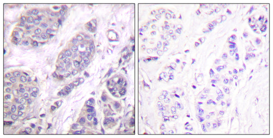 TGFβ3 Rabbit Polyclonal Antibody