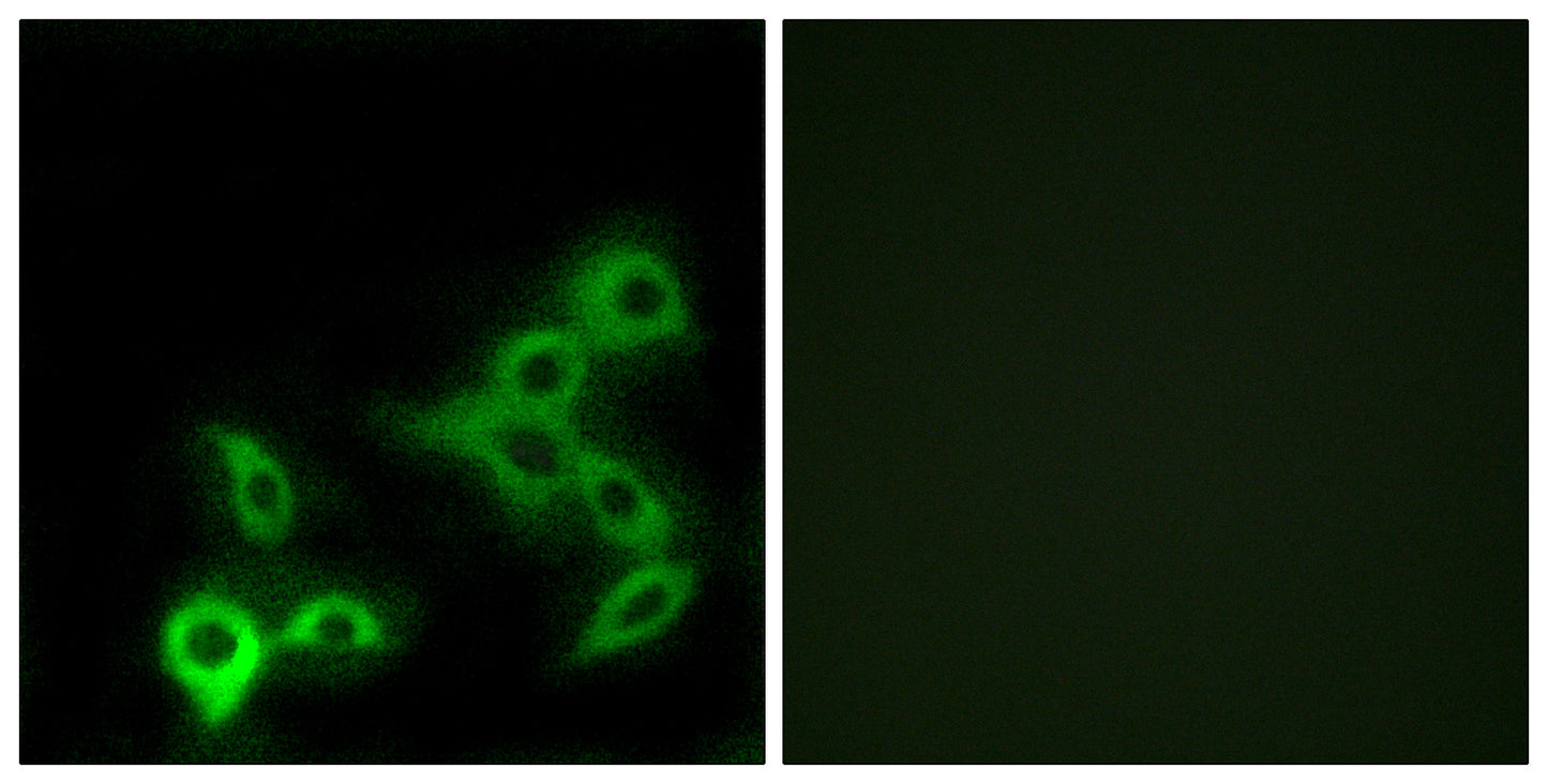 TGR5 Rabbit Polyclonal Antibody