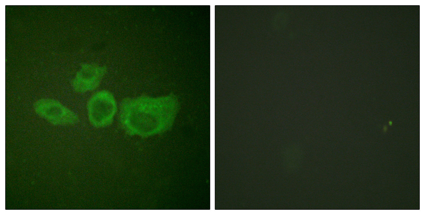 TH Rabbit Polyclonal Antibody
