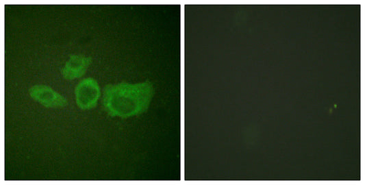 TH Rabbit Polyclonal Antibody