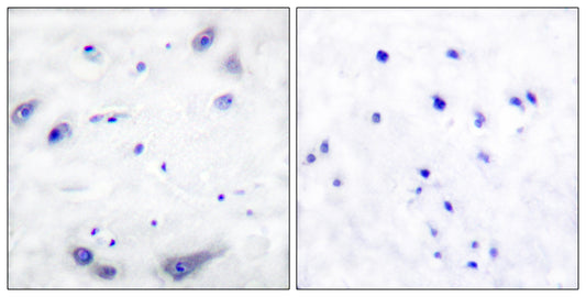TH Rabbit Polyclonal Antibody