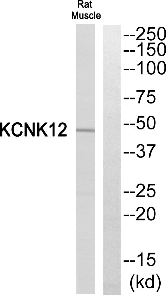 THIK-2 Rabbit Polyclonal Antibody