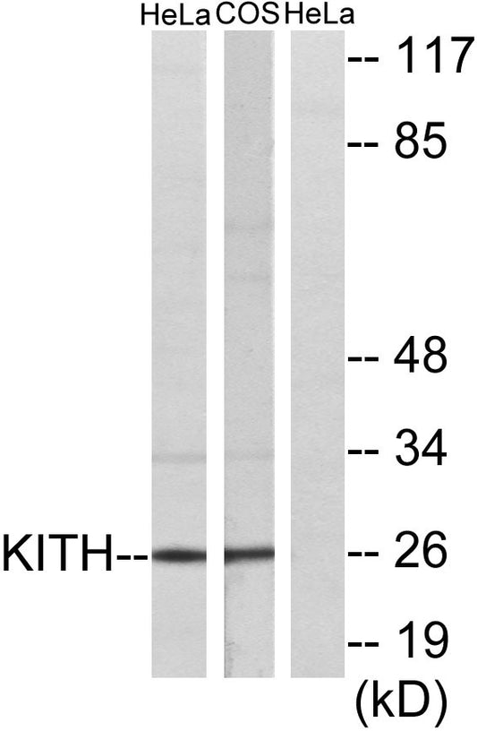Thymidine Kinase Rabbit Polyclonal Antibody