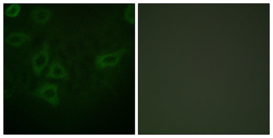 Thymidine Kinase Rabbit Polyclonal Antibody