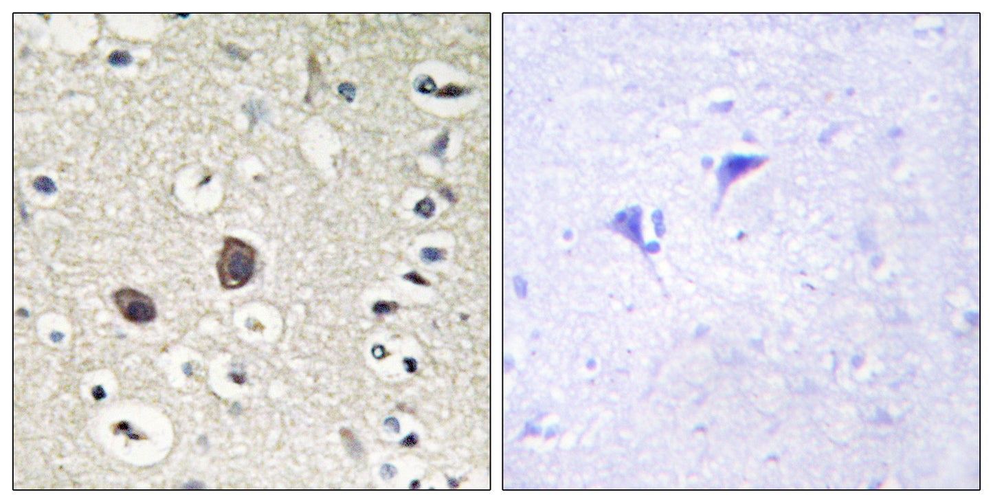 Tie-2 Rabbit Polyclonal Antibody