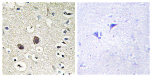Tie-2 Rabbit Polyclonal Antibody