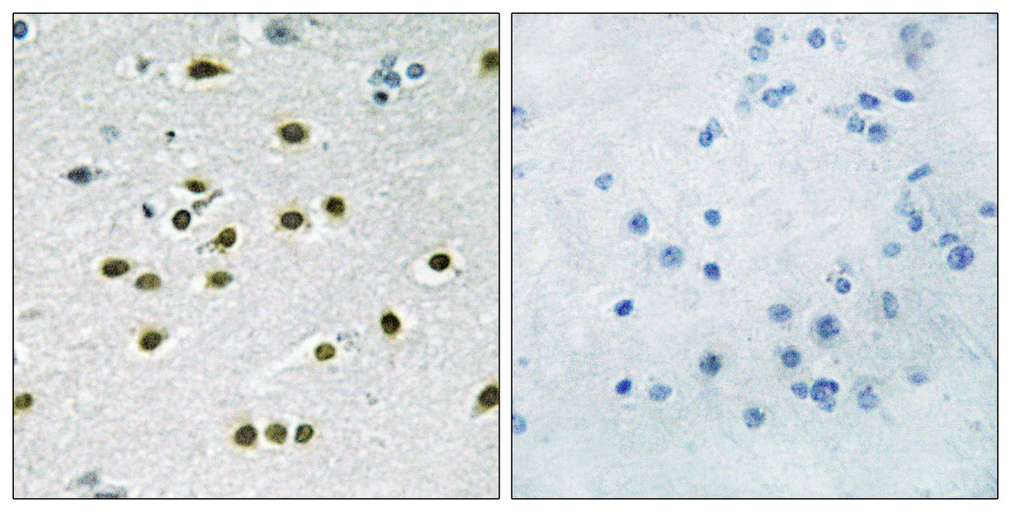 TIEG-1/2 Rabbit Polyclonal Antibody