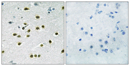 TIEG-1/2 Rabbit Polyclonal Antibody