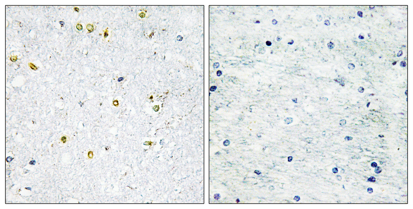 TIF1α Rabbit Polyclonal Antibody