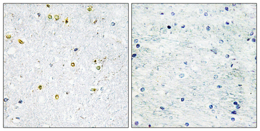 TIF1α Rabbit Polyclonal Antibody