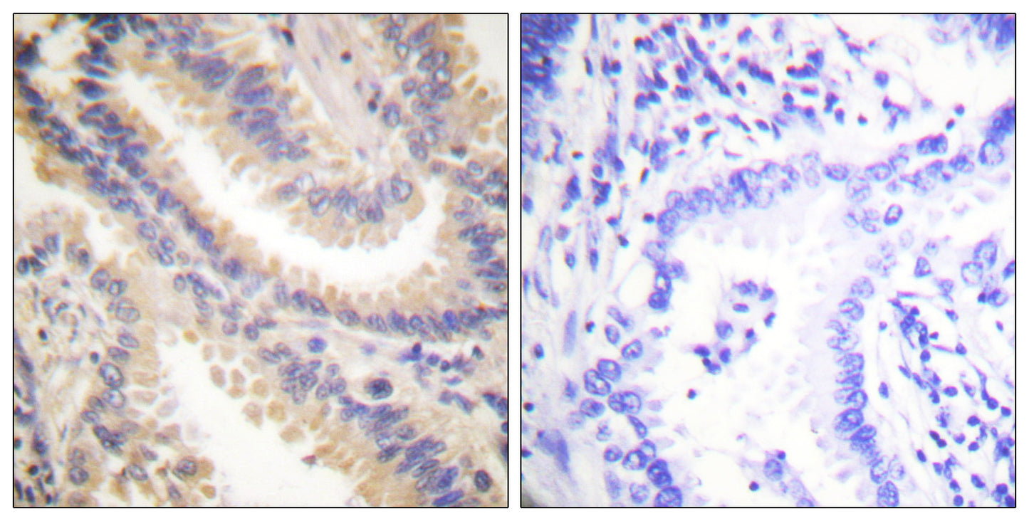 TIMP-4 Rabbit Polyclonal Antibody