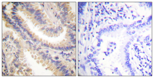 TIMP-4 Rabbit Polyclonal Antibody