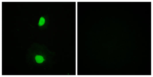 TIP60 Rabbit Polyclonal Antibody