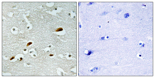 TIP60 Rabbit Polyclonal Antibody