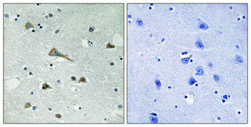 TIRAP Rabbit Polyclonal Antibody