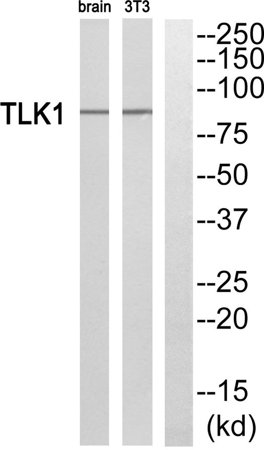 TLK1 Rabbit Polyclonal Antibody