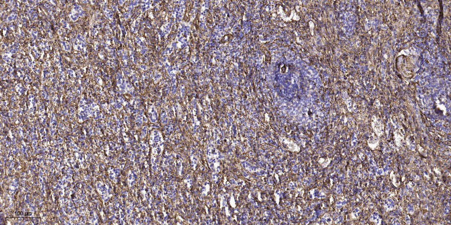 TLN2 Rabbit Polyclonal Antibody