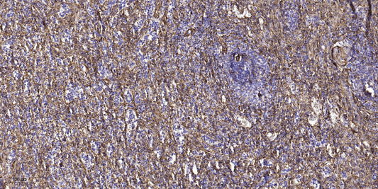 TLN2 Rabbit Polyclonal Antibody