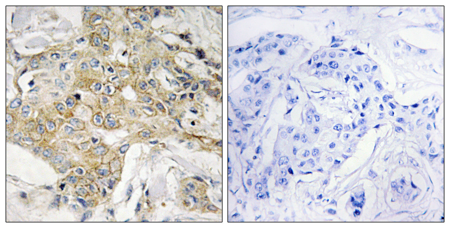 TM4SF1 Rabbit Polyclonal Antibody