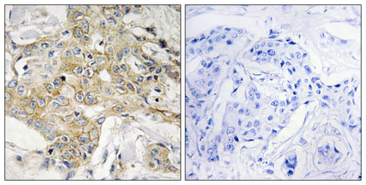 TM4SF1 Rabbit Polyclonal Antibody