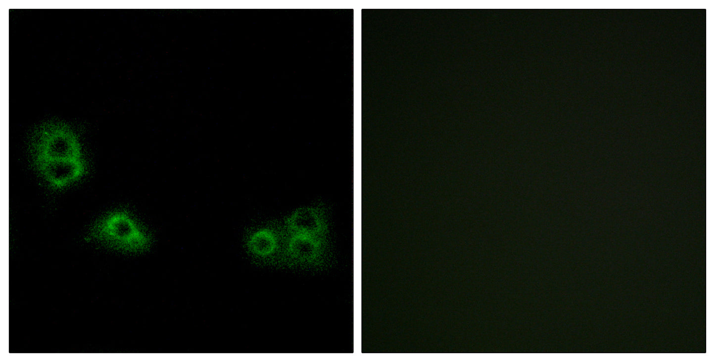 TMEM185A Rabbit Polyclonal Antibody