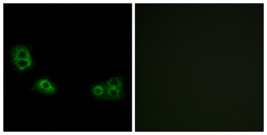 TMEM185A Rabbit Polyclonal Antibody