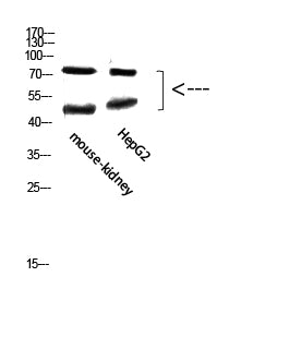 TMPO Rabbit Polyclonal Antibody