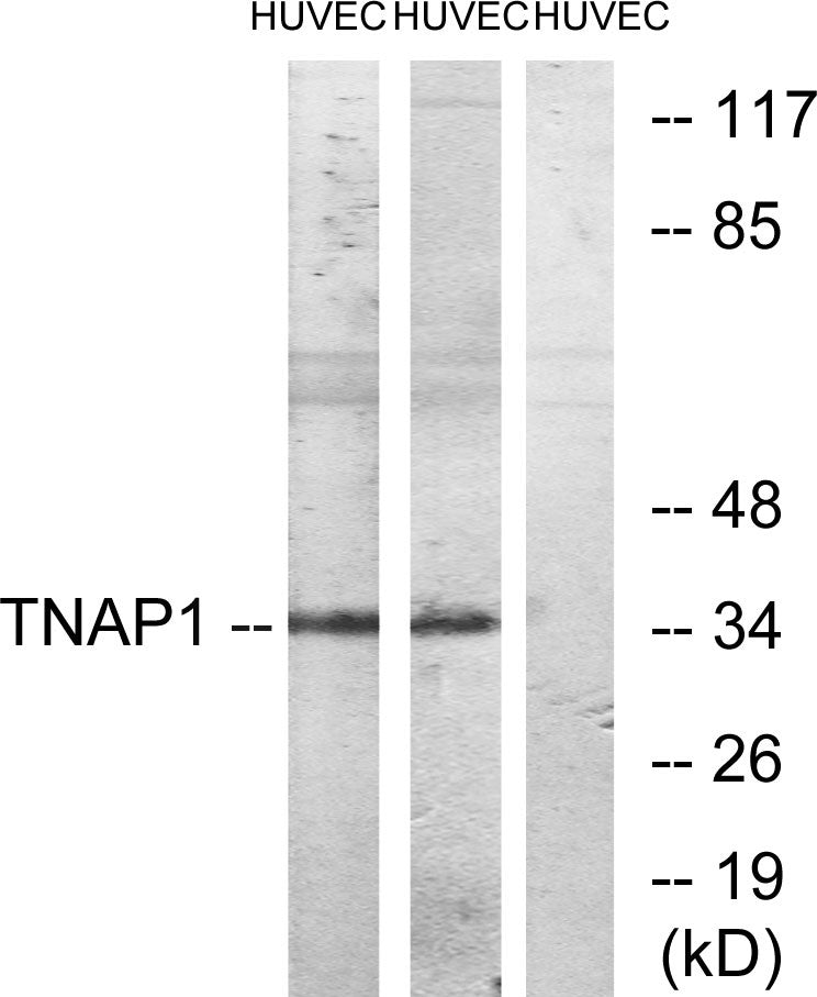 TNF-IP 1 Rabbit Polyclonal Antibody