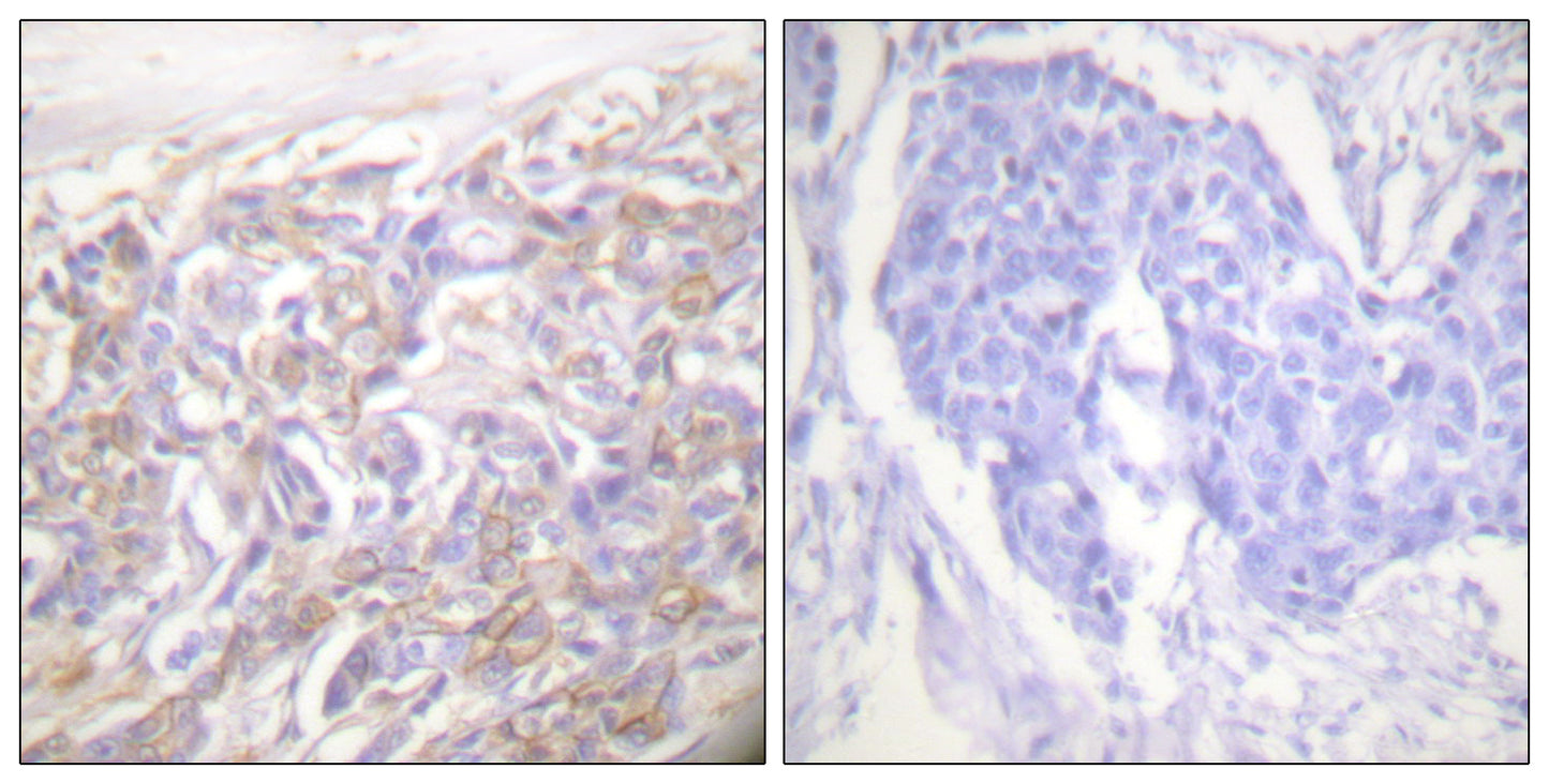 TNF-R1 Rabbit Polyclonal Antibody