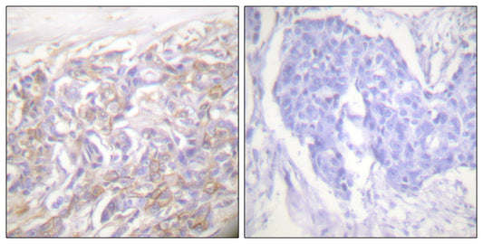TNF-R1 Rabbit Polyclonal Antibody
