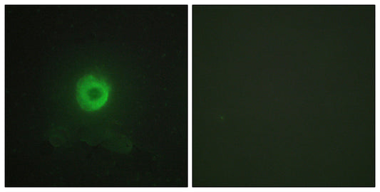 TNF-R2 Rabbit Polyclonal Antibody