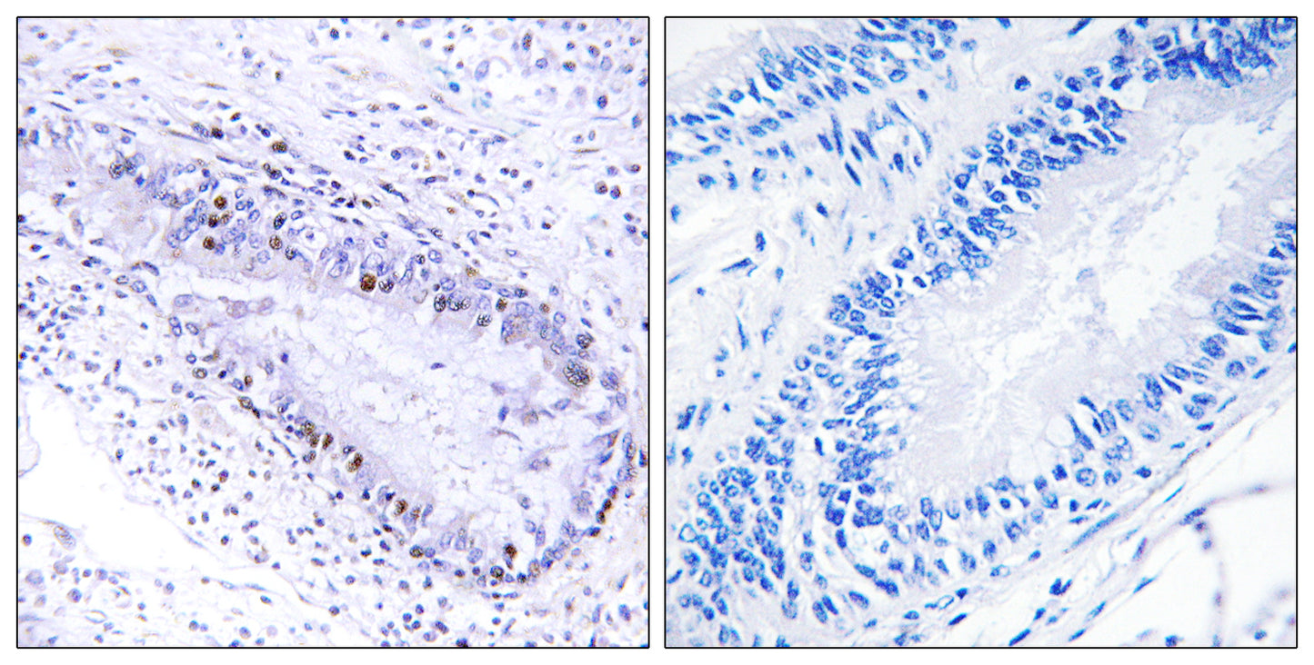 TP1 Rabbit Polyclonal Antibody
