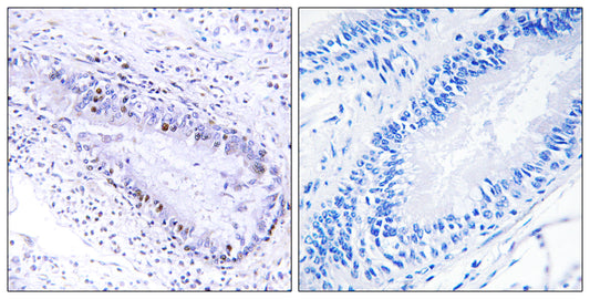TP1 Rabbit Polyclonal Antibody