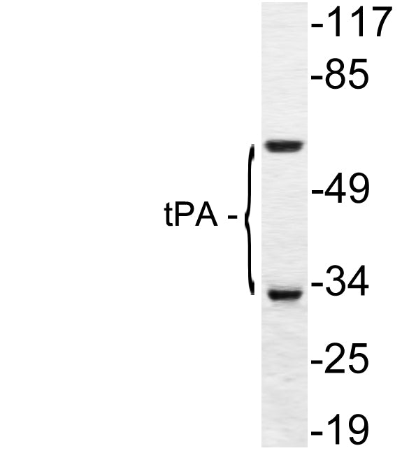 tPA Rabbit Polyclonal Antibody