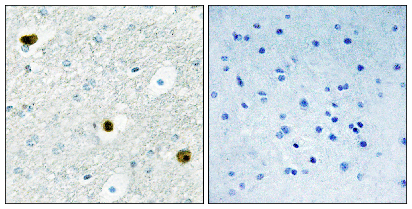 TPD52 Rabbit Polyclonal Antibody