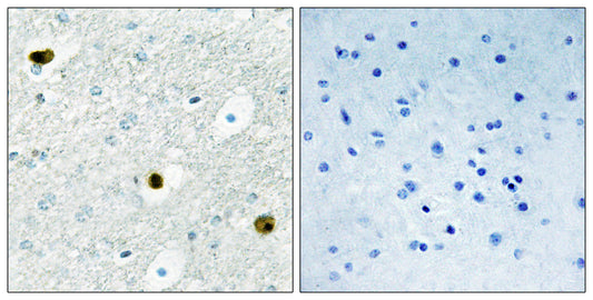 TPD52 Rabbit Polyclonal Antibody