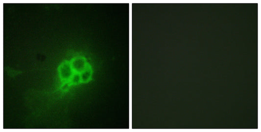 TPH1 Rabbit Polyclonal Antibody