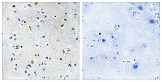 TPX2 Rabbit Polyclonal Antibody