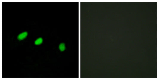 Tra-2α Rabbit Polyclonal Antibody