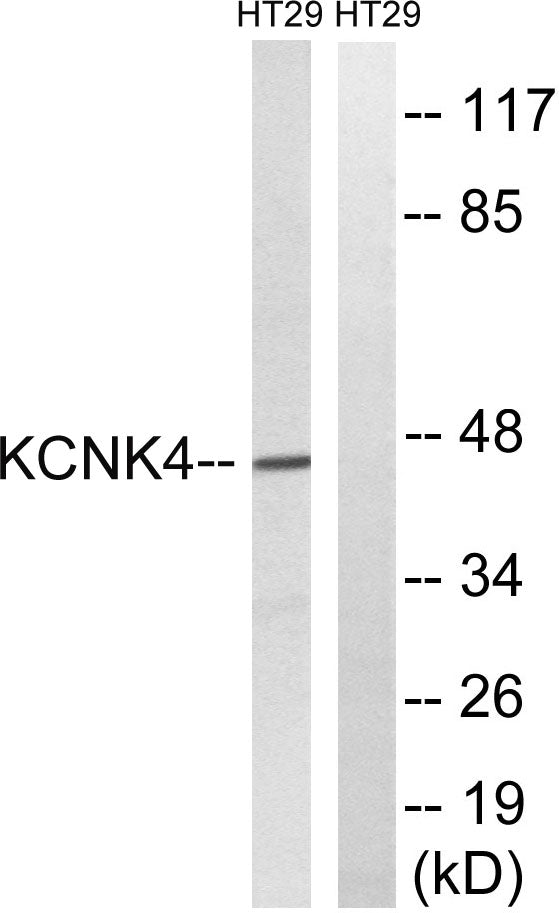 TRAAK Rabbit Polyclonal Antibody