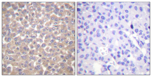 TRADD Rabbit Polyclonal Antibody