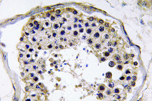 TRAF6 Rabbit Polyclonal Antibody