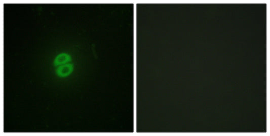 TRAIL Rabbit Polyclonal Antibody