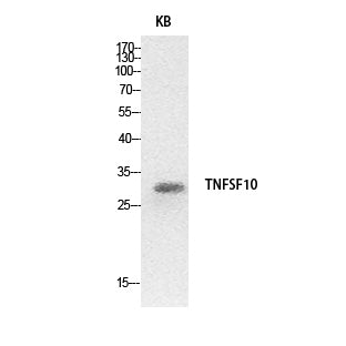 TRAIL Rabbit Polyclonal Antibody