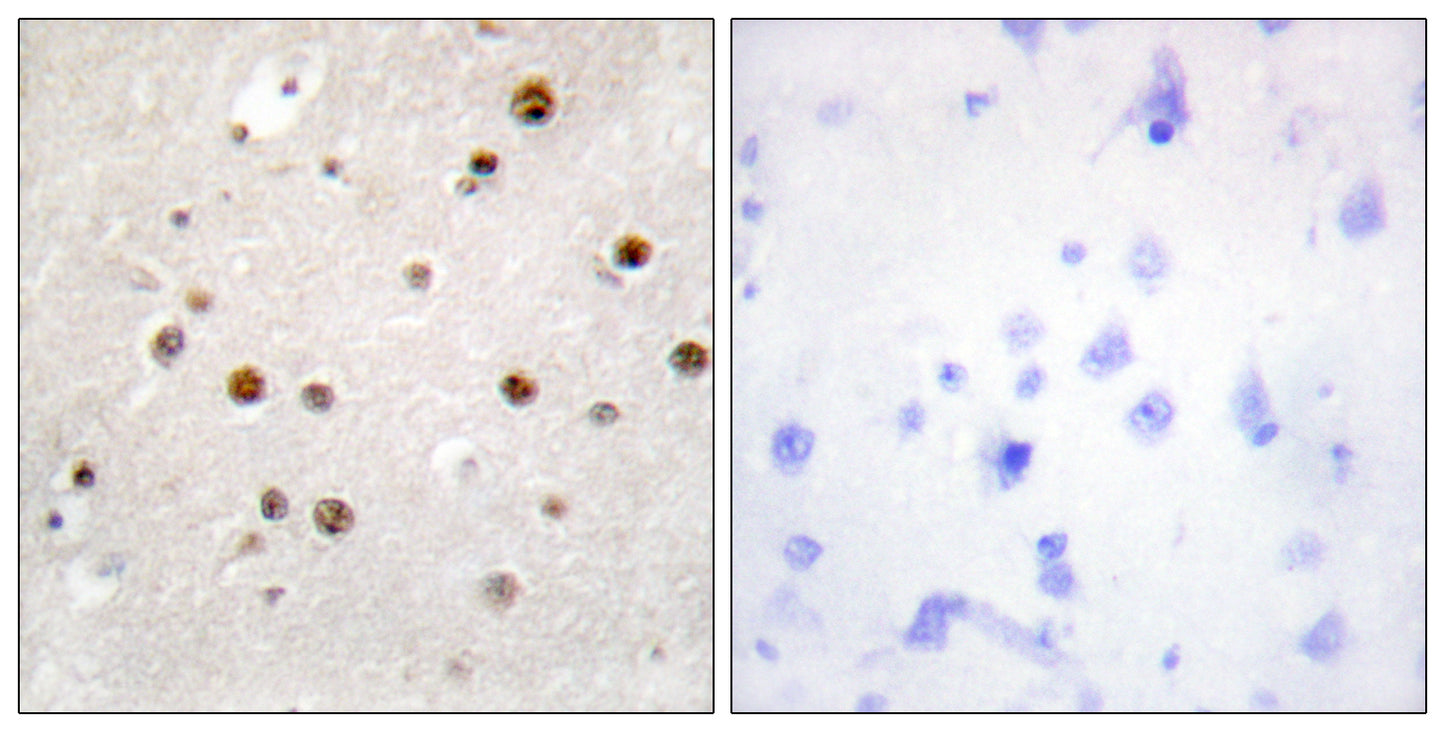 Translin Rabbit Polyclonal Antibody